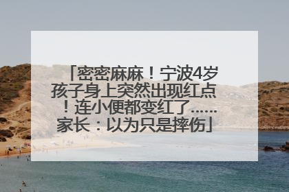 密密麻麻！宁波4岁孩子身上突然出现红点！连小便都变红了……家长：以为只是摔伤